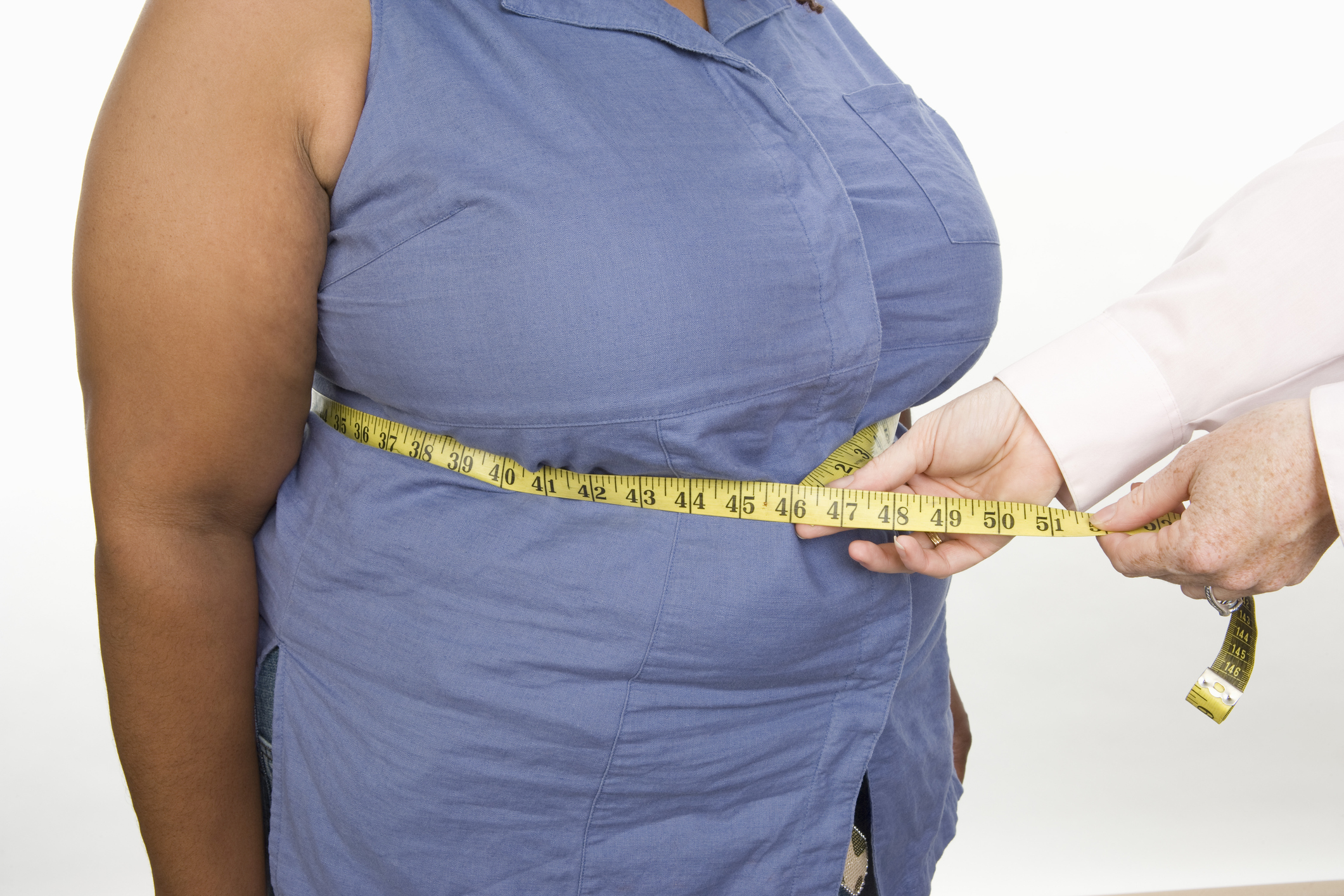 Увеличение веса заболевание. Ожирение. Лишний вес. Лишний вес и ожирение.