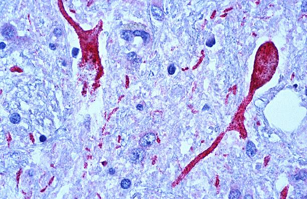 Un giro inesperado en el mapa del cerebro