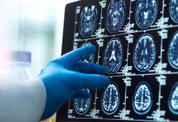 Tres hábitos que pueden marcar la diferencia para proteger el cerebro con el paso de los años